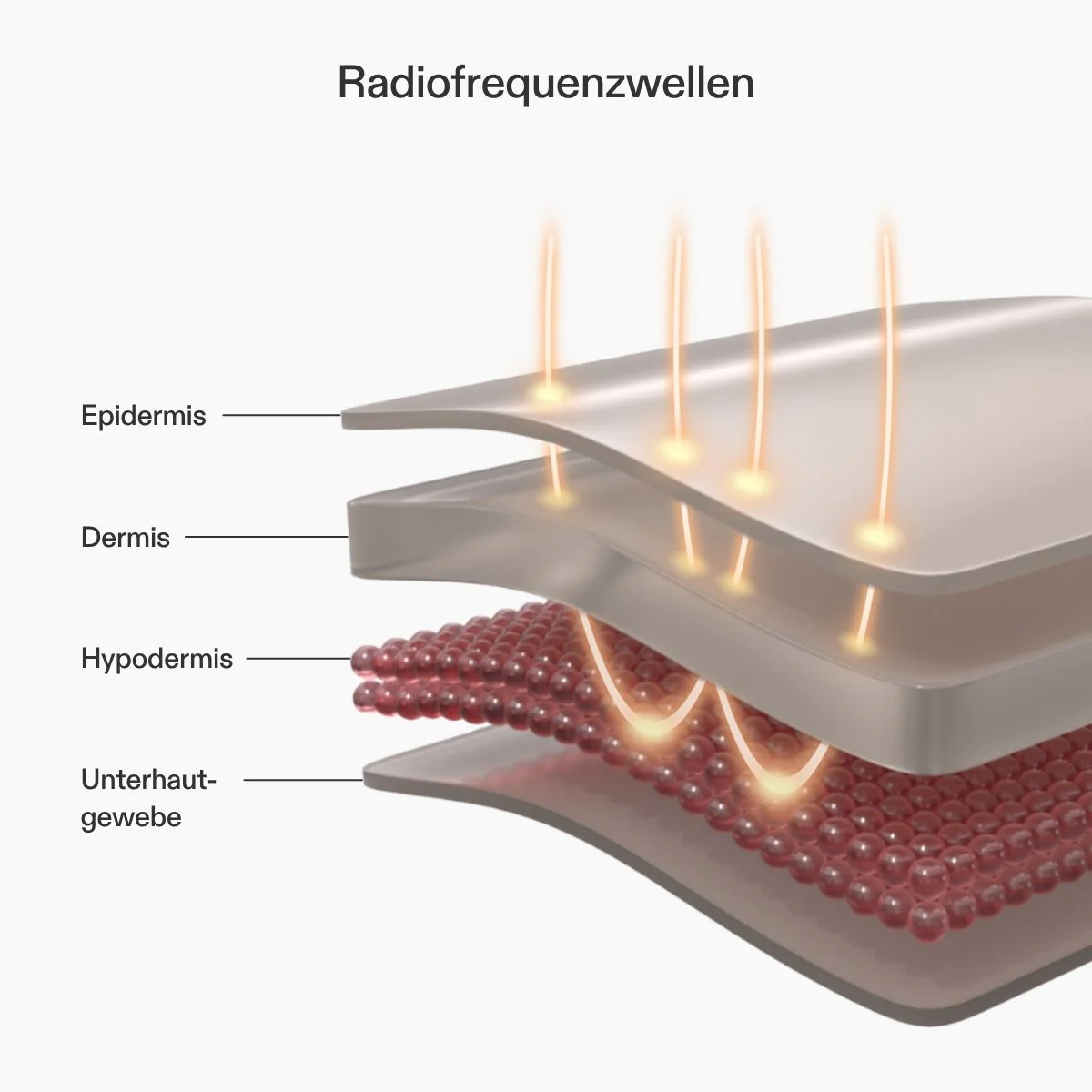 CurrentBody Skin RF Radiofrequenz-Hautstraffungsgerät - Image 4