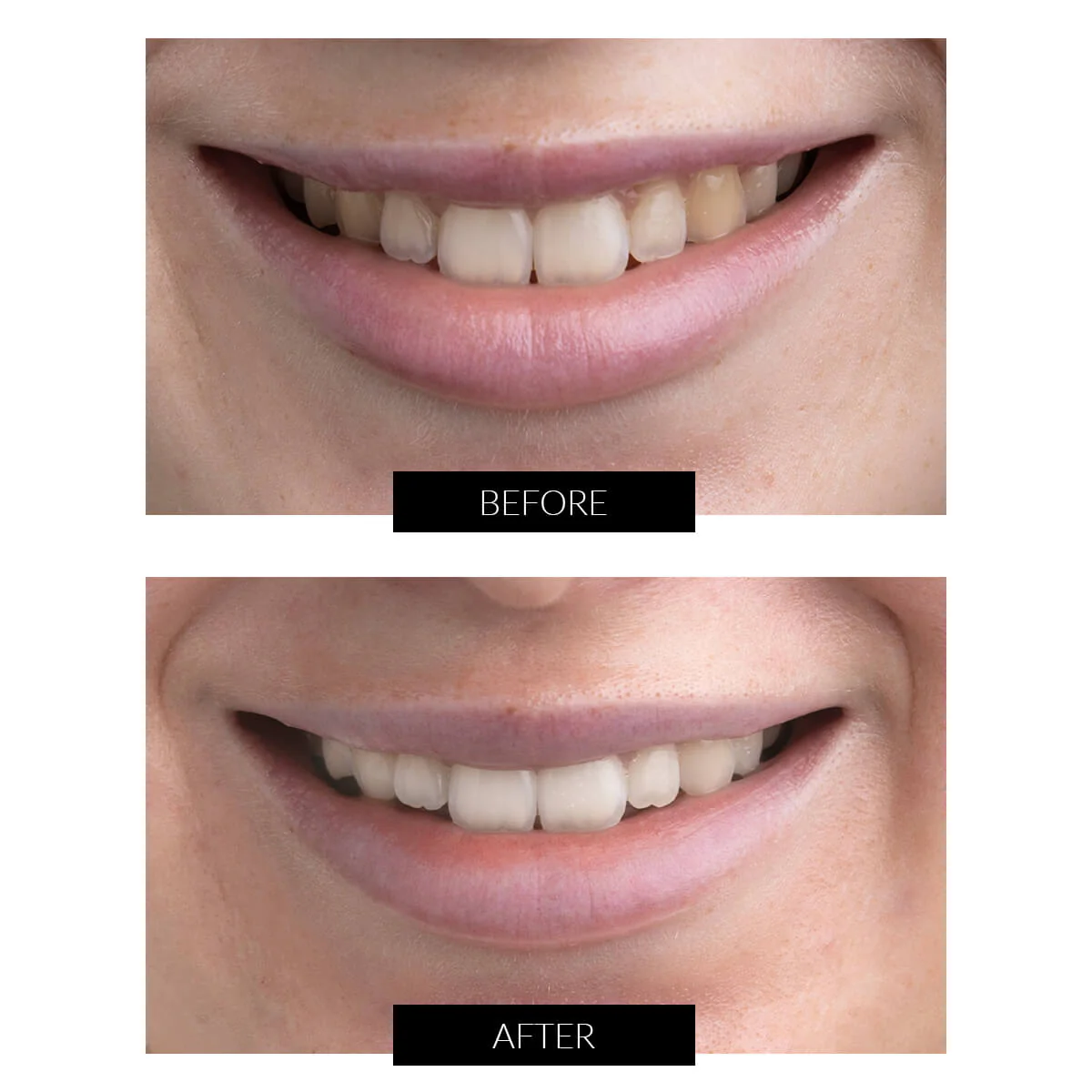 CurrentBody Skin Teeth Whitening Extended Kit - Image 4